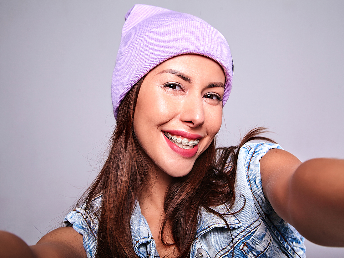 clear braces in Centennial, CO